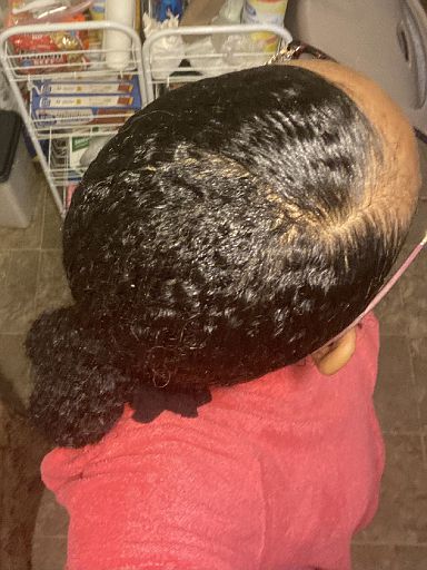 Top of Head - Very Few Broken Hairs